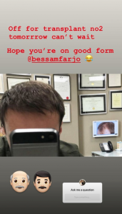 Alan Halsall undergoing hair transplant