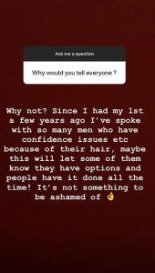 Alan Halsall undergoing hair transplant