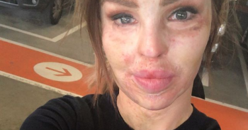 Katie Piper (Credit: Instagram @katiepiper_)