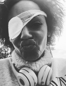 Mel B with her eye patch