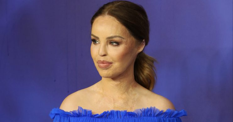 Katie Piper