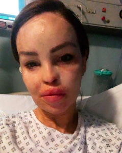 Katie Piper hospital Instagram @katiepiper_