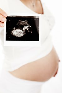 Pregnant woman