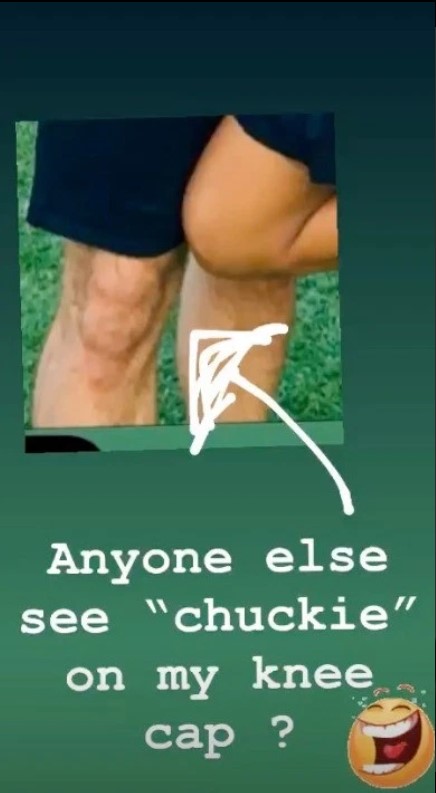 Alan Halsall knee