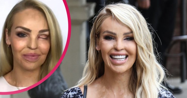 Katie Piper