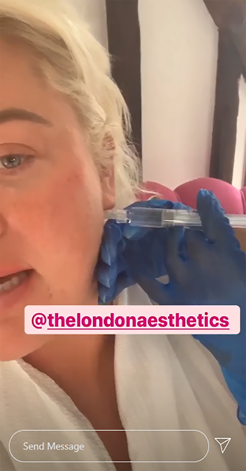 Gemma Collins injections