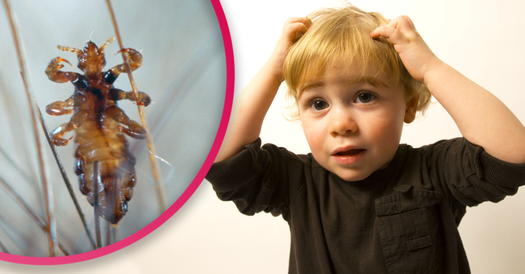head lice