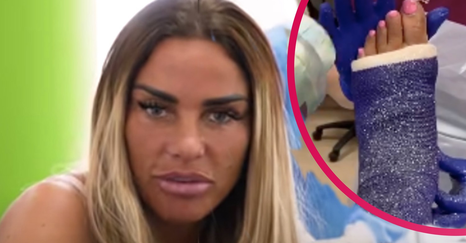 katie price feet broken glitter cast