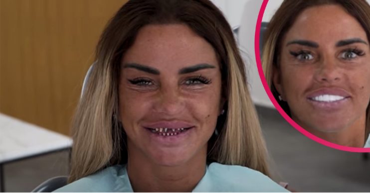 katie price veneers