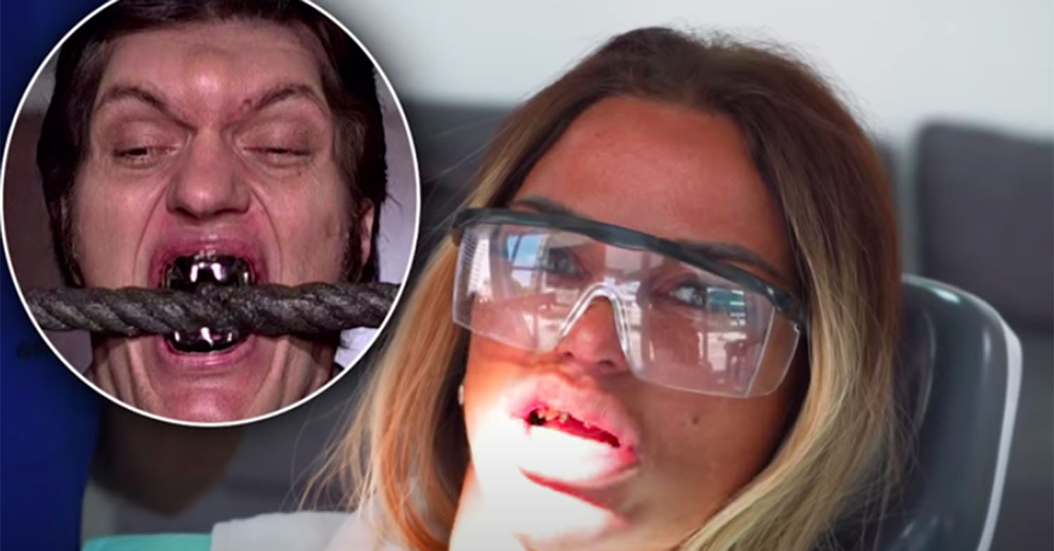 katie price james bond teeth