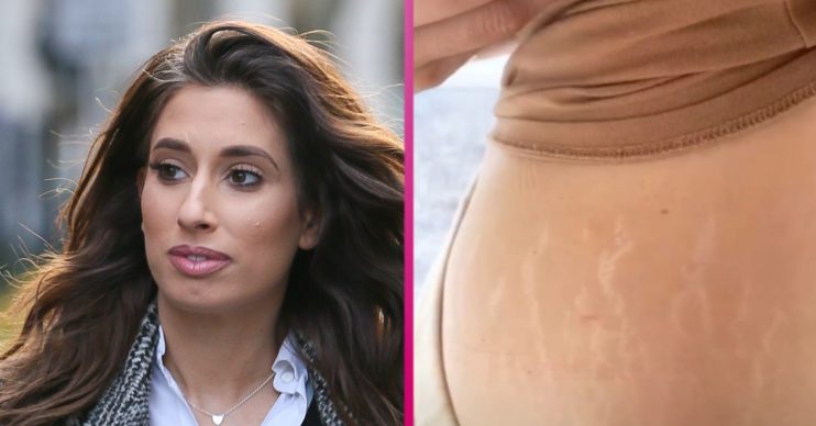 stacey solomon stretch marks wp