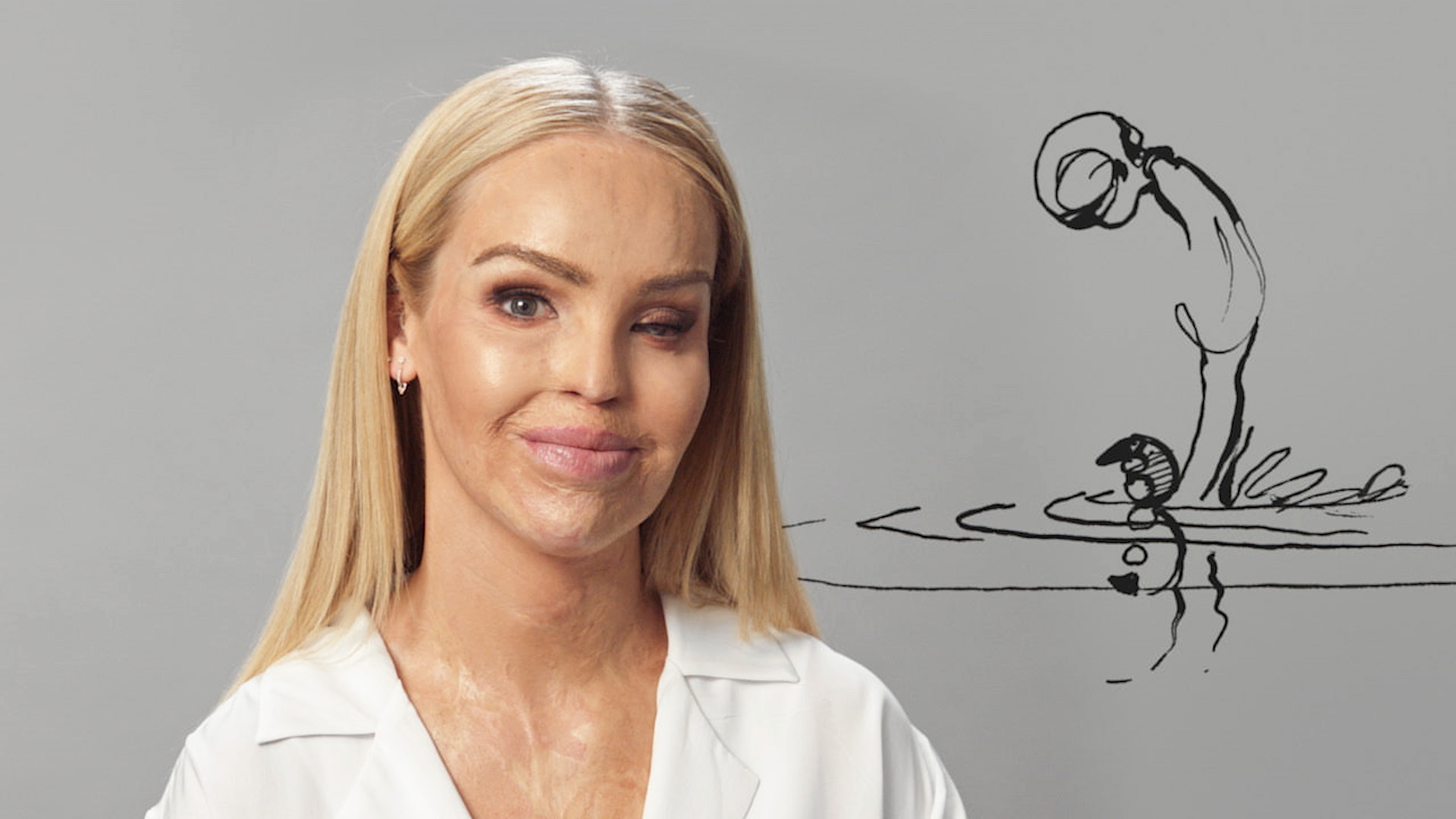 Katie piper
