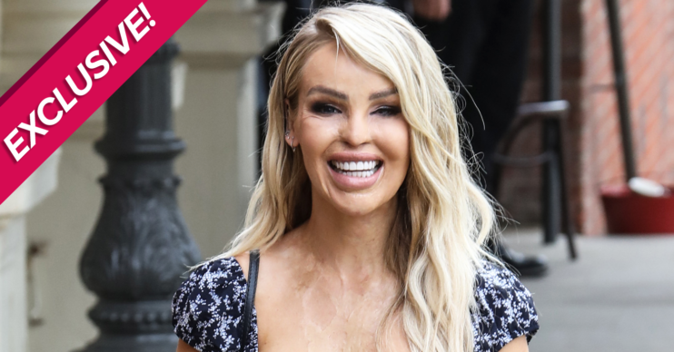 Katie piper
