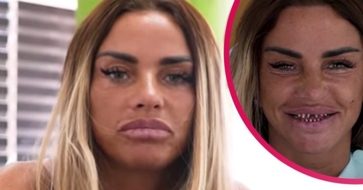 katie price veneers turkey