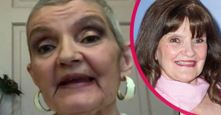 anne nolan breast cancer 2020