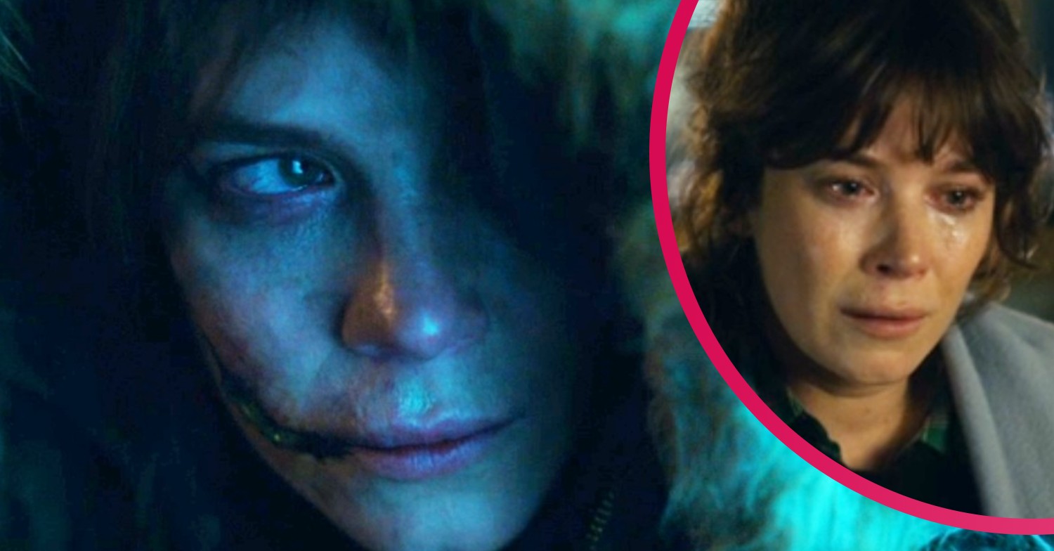 Marcella scar