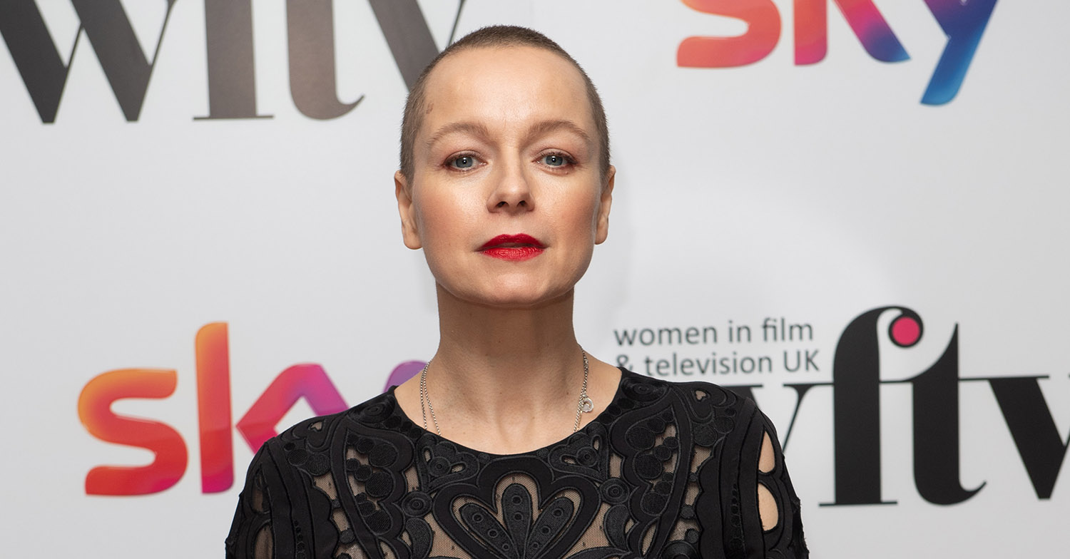 samantha morton bald
