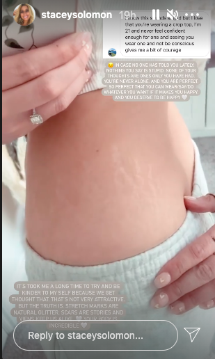 stacey solomon stretch marks