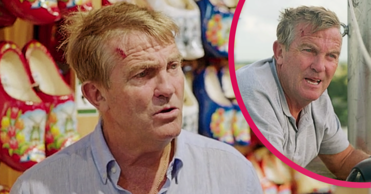 Bradley Walsh suffered a head injury on Breaking Dad