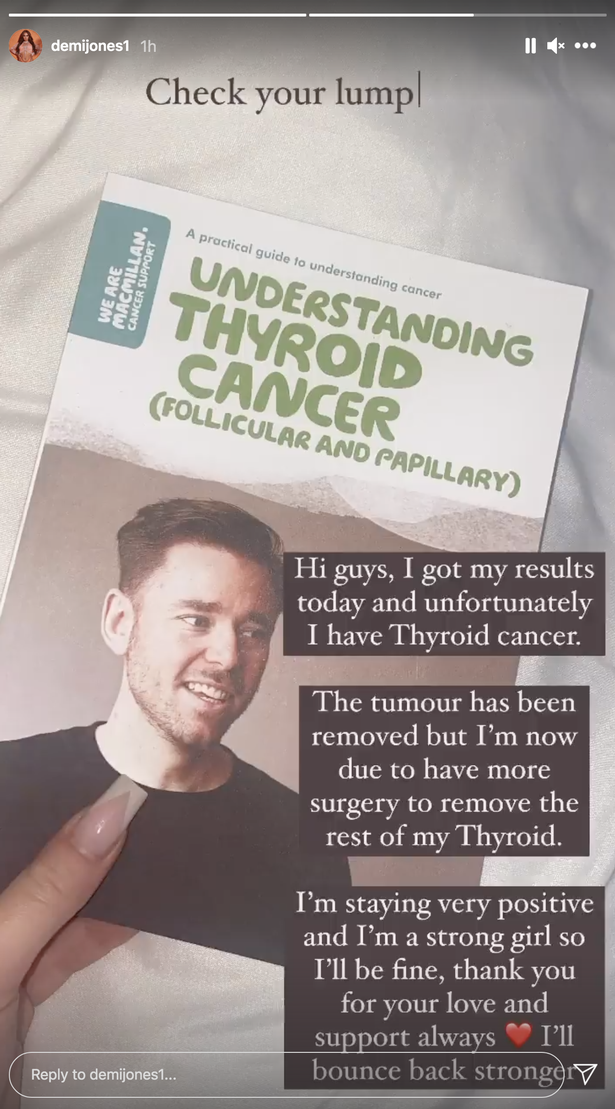 Demi Jones from Love Island has Cancer