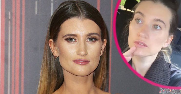 Emmerdale star Charley Webb