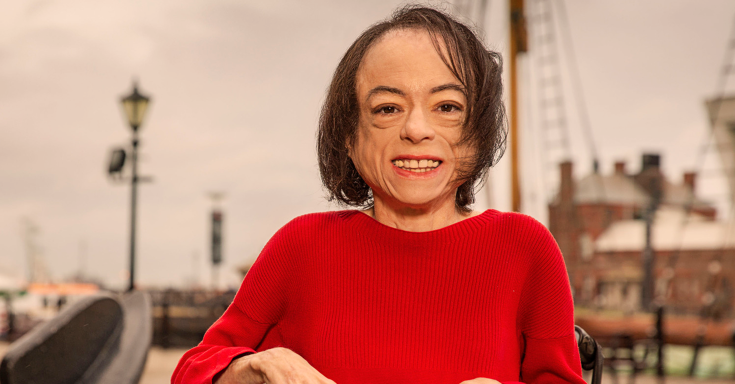 Silent Witness star Liz Carr