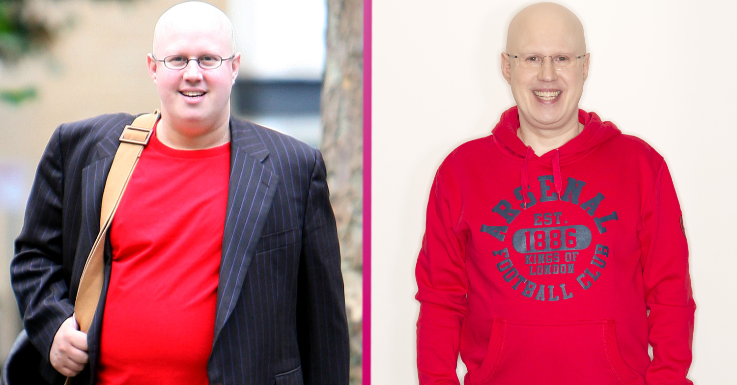 before and after