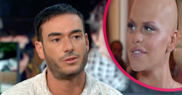 Jack Tweed and Jade Goody with no hair