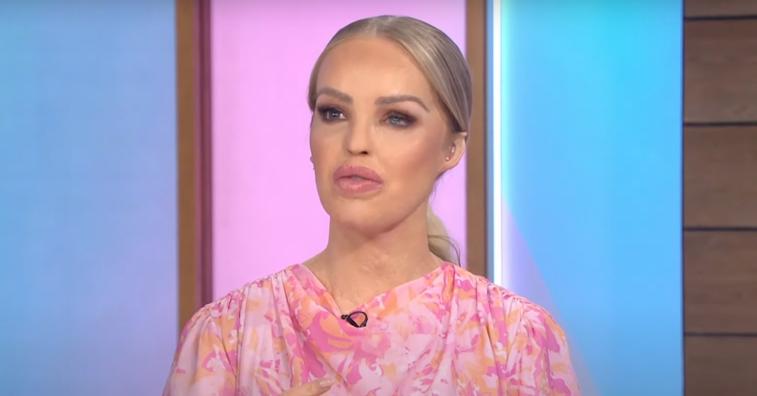 Katie Piper speaking on Loose Women today