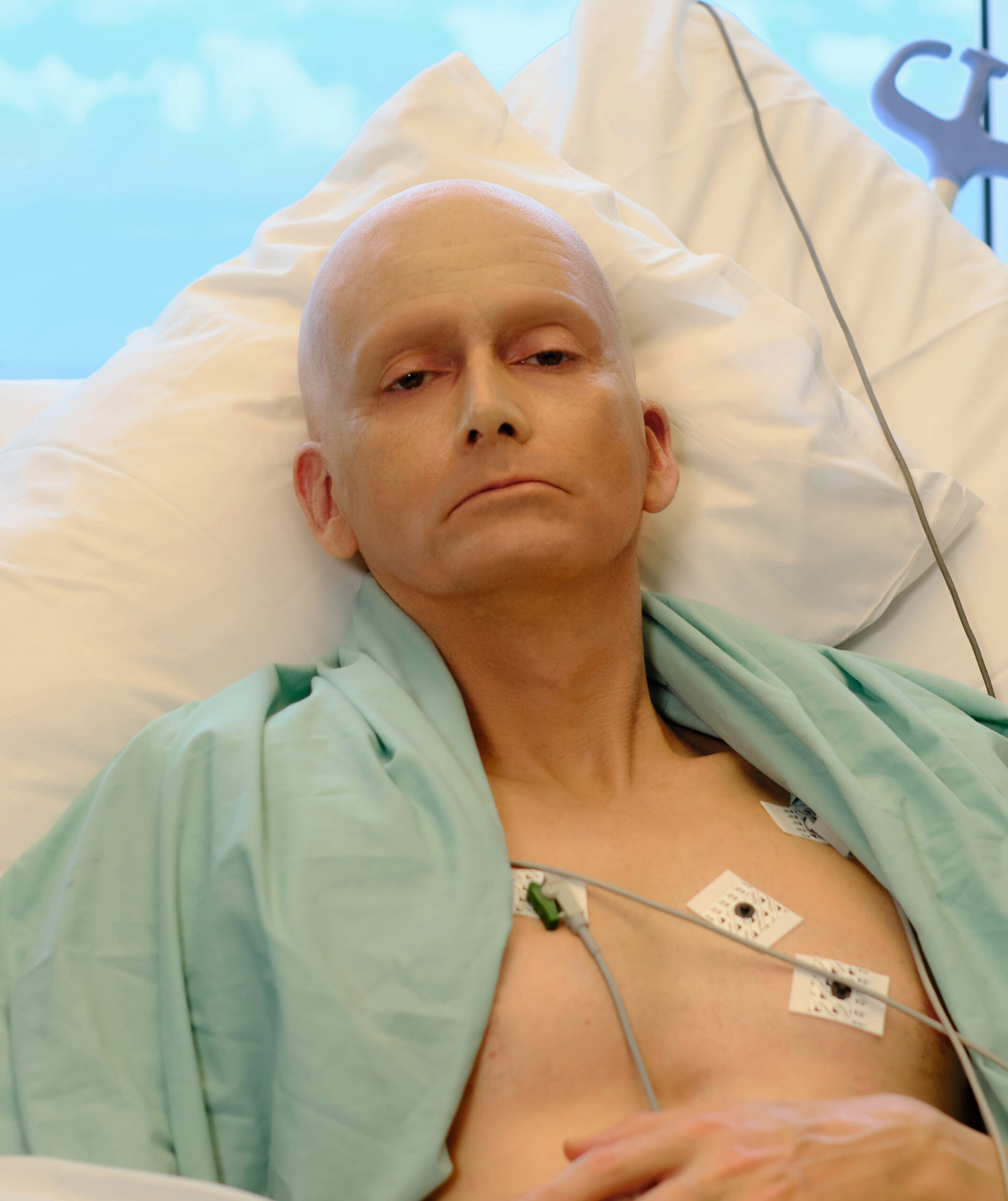 A bald David Tennant in character as LITVINENKO on ITVX