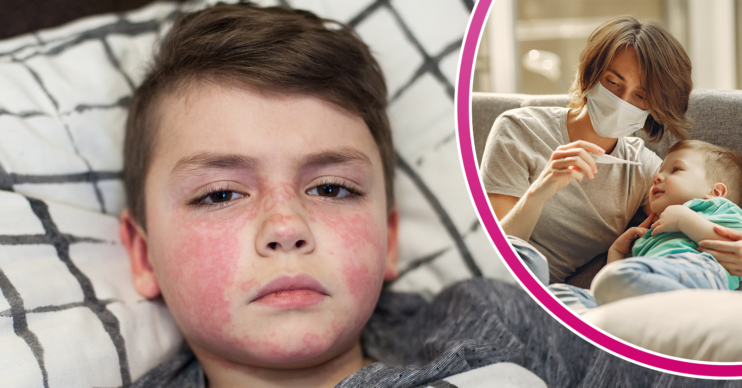 Child with a Scarlet Fever rash and having temperature taken inset
