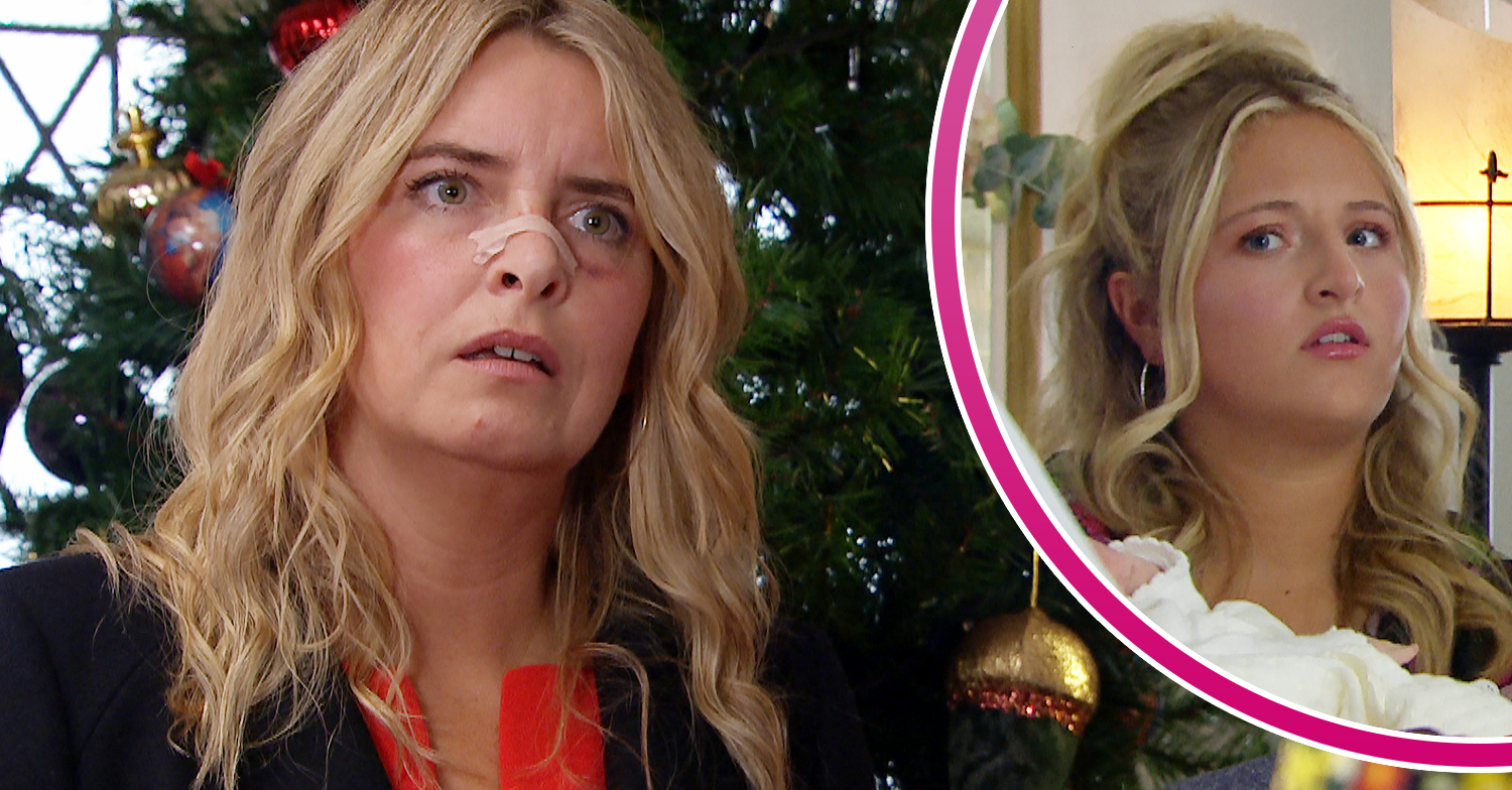 Emmerdale's Charity has a plaster on her nose and is looking angry, and in a bubble, Amelia is looking shocked