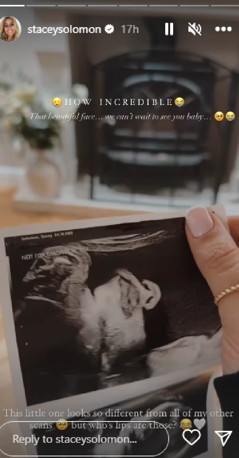 Stacey Solomon reveals baby scan on Instagram