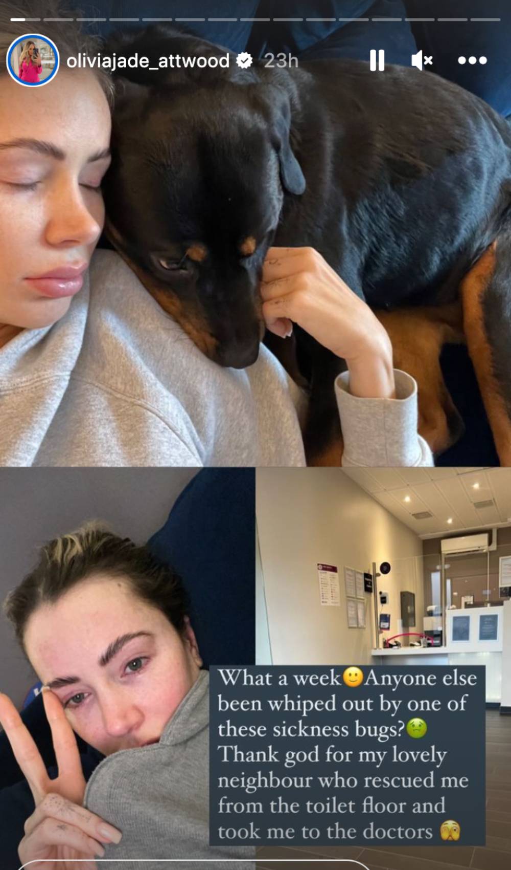 Olivia Attwood shares a health update on Instagram Stories