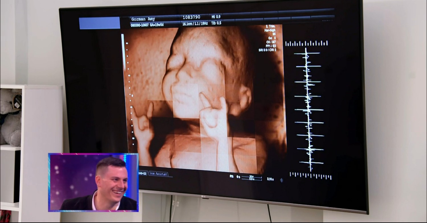 A fake baby scan on Saturday Night Takeaway 2023 