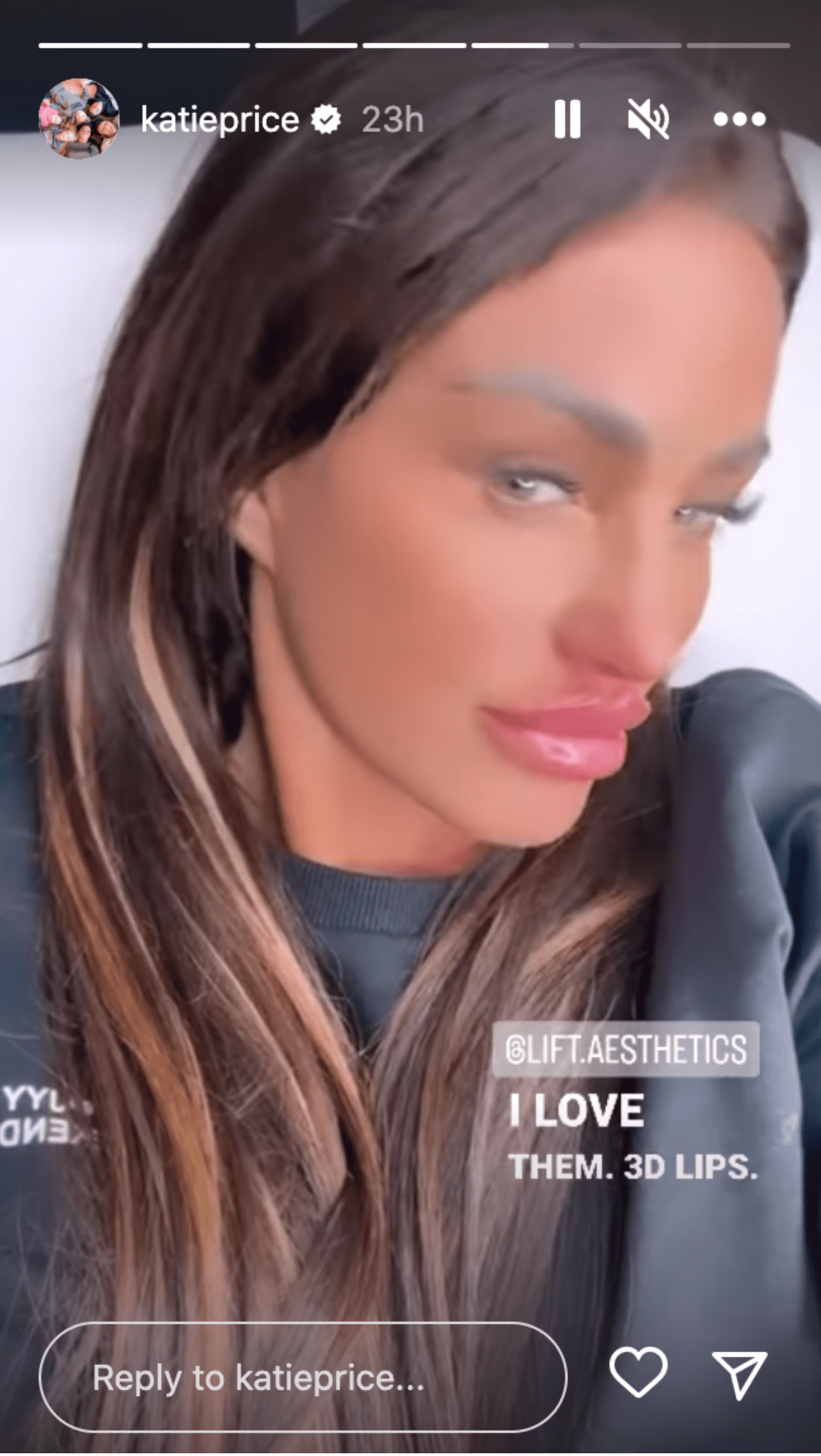 Katie Price pouts with new lips