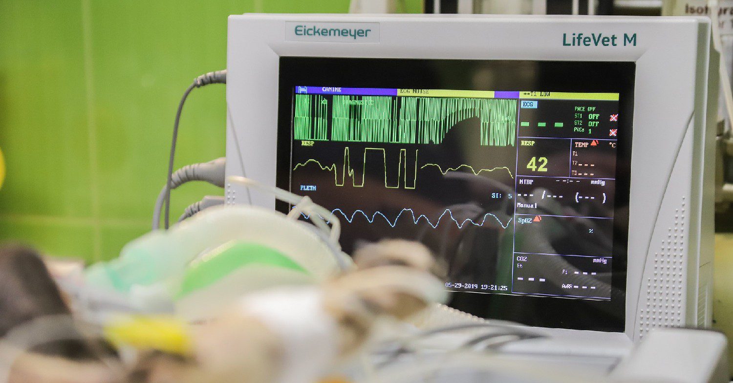 Heart monitor 