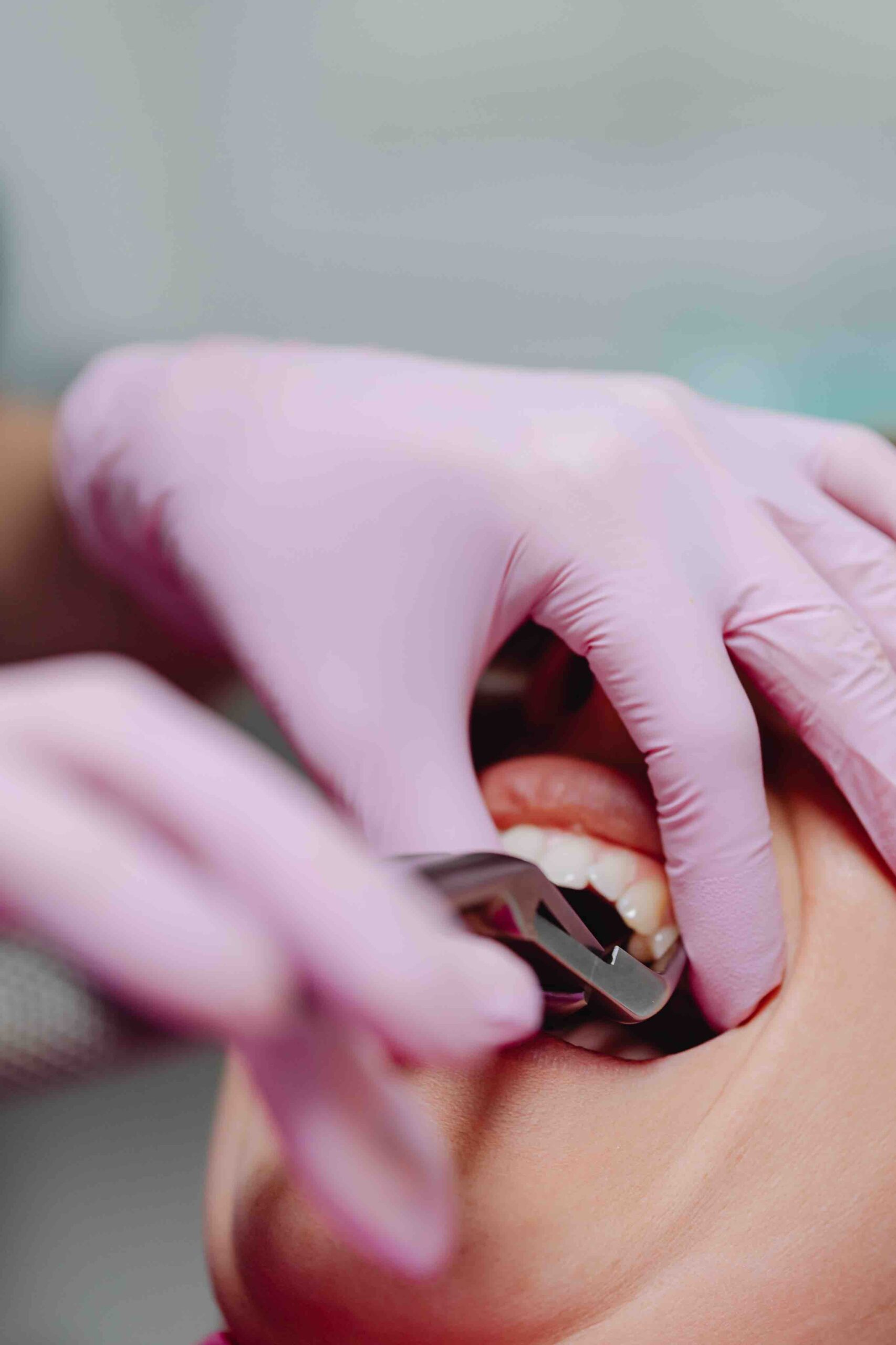 Dentist treating a patient 