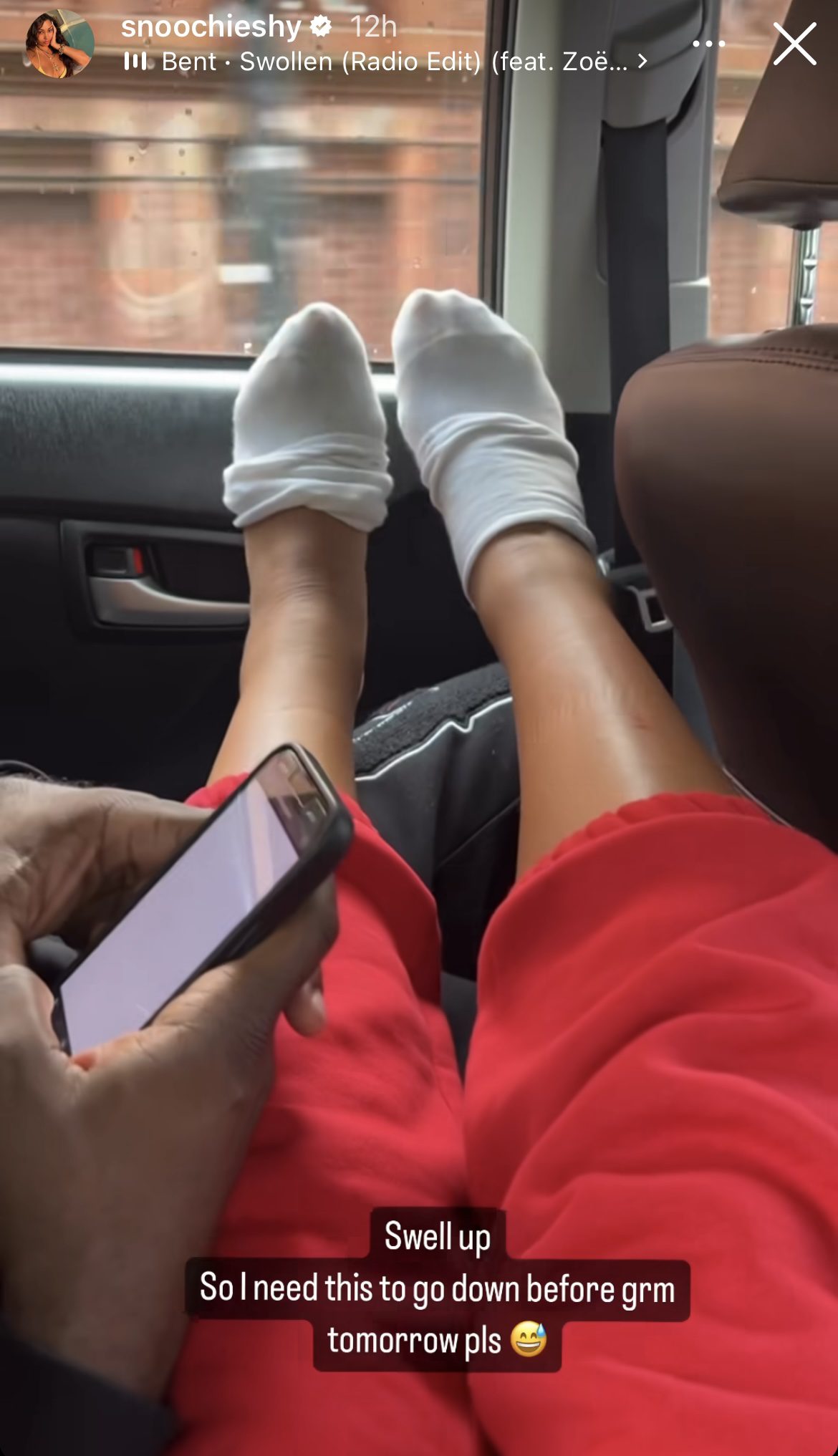 Snoochie Shy swollen feet