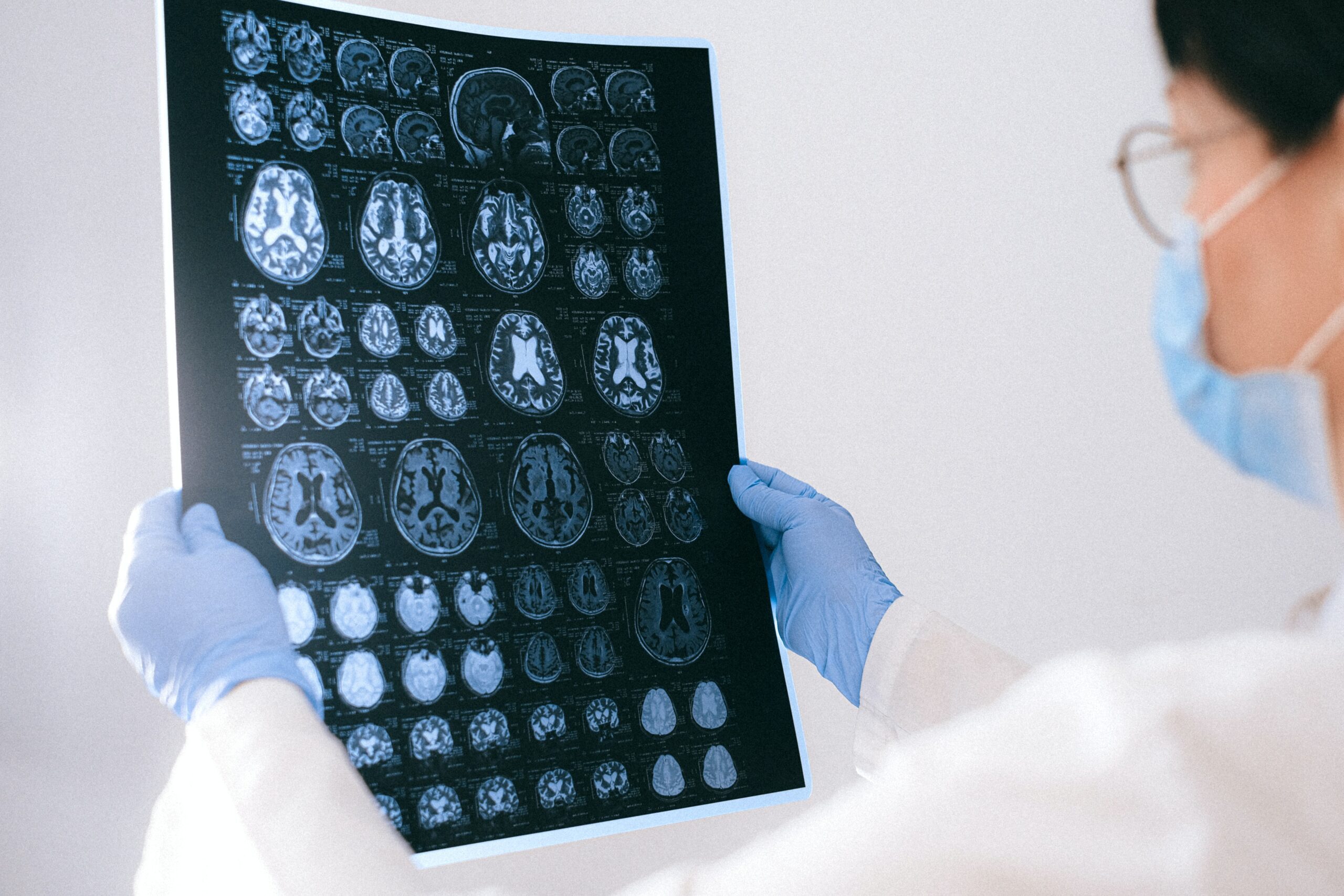 Doctor looks at brain scans