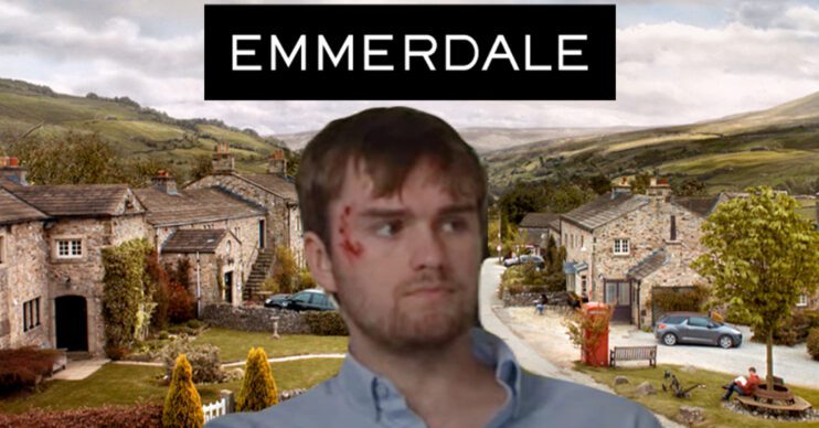 Emmerdale's Tom, the Emmerdale logo and background of the Dales