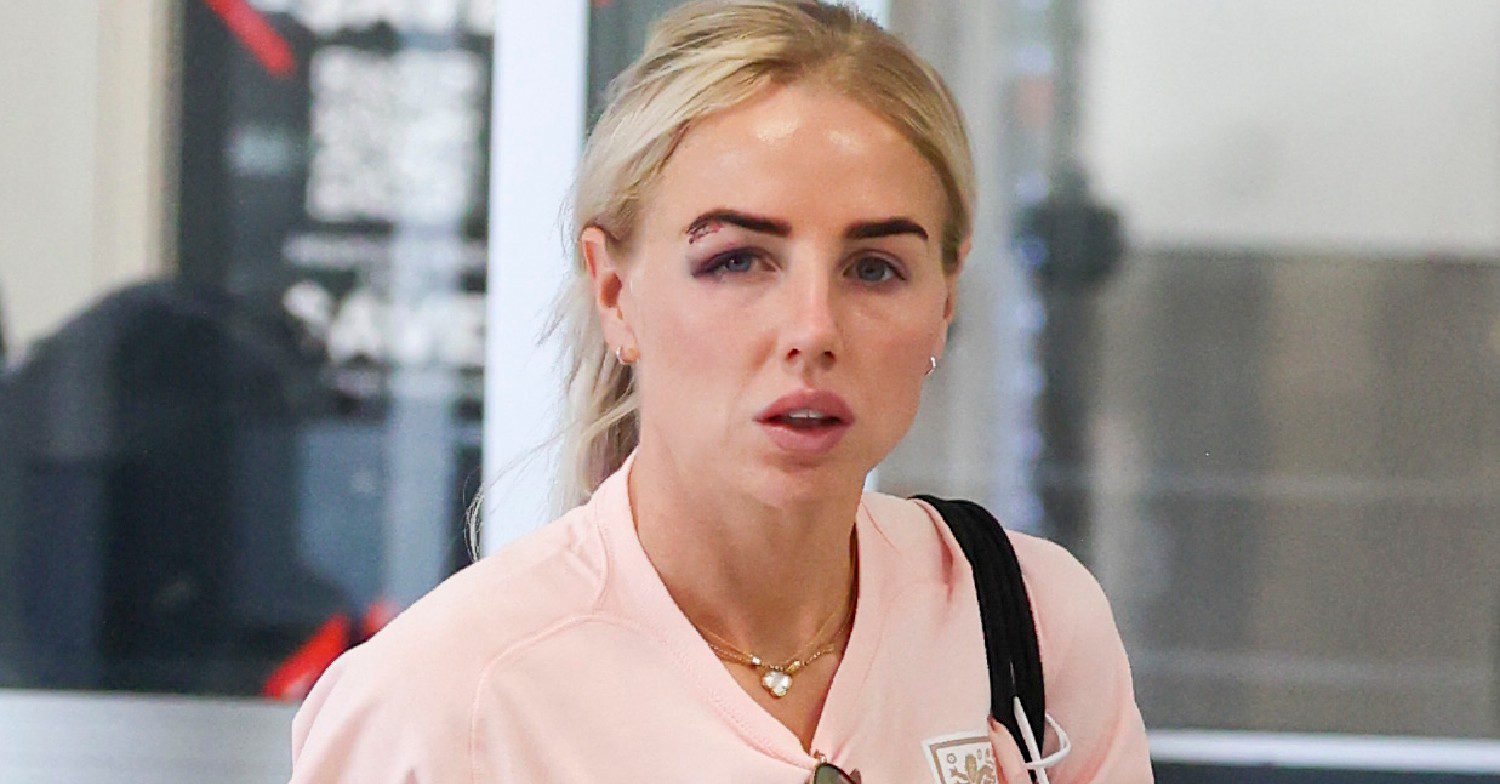 Alex Greenwood