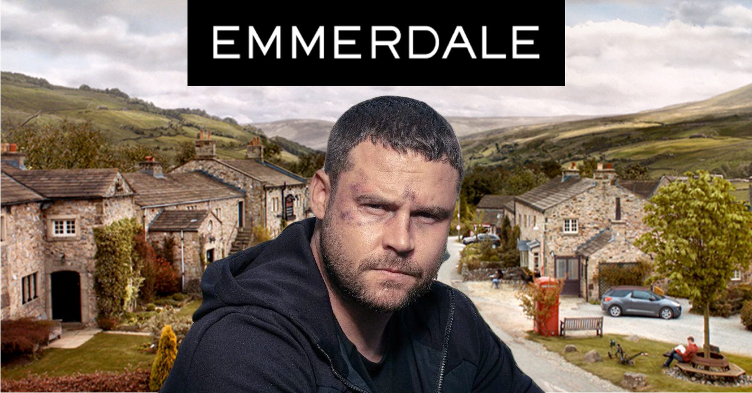 Emmerdale's Aaron, the Emmerdale logo and background of the Dales