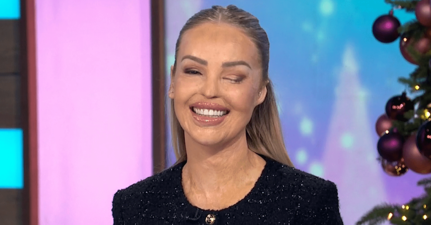 Katie Piper