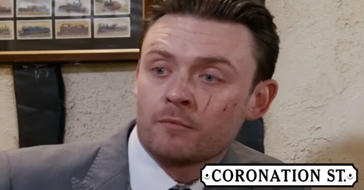 Coronation Street's Joel has scratches on his face, the Corrie logo