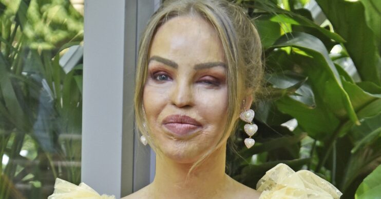 Katie Piper smiling in a yellow dress