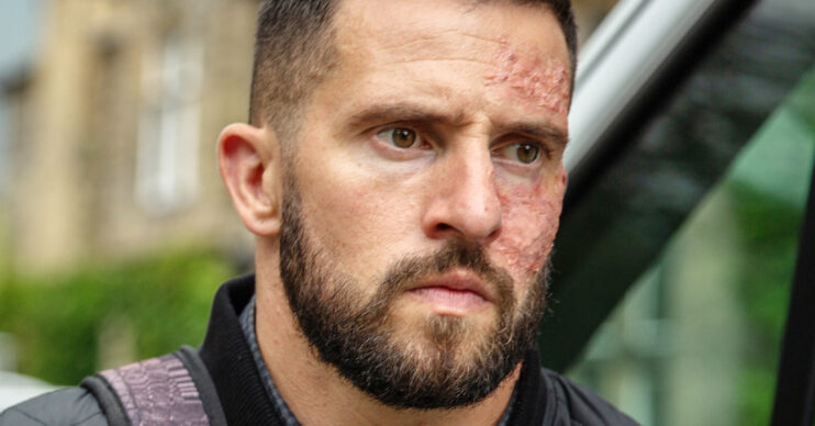 Emmerdale's Ross Barton is serious