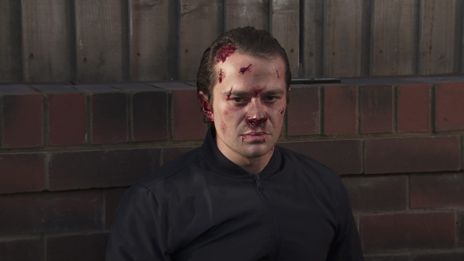 Coronation Street's Seb's face cut