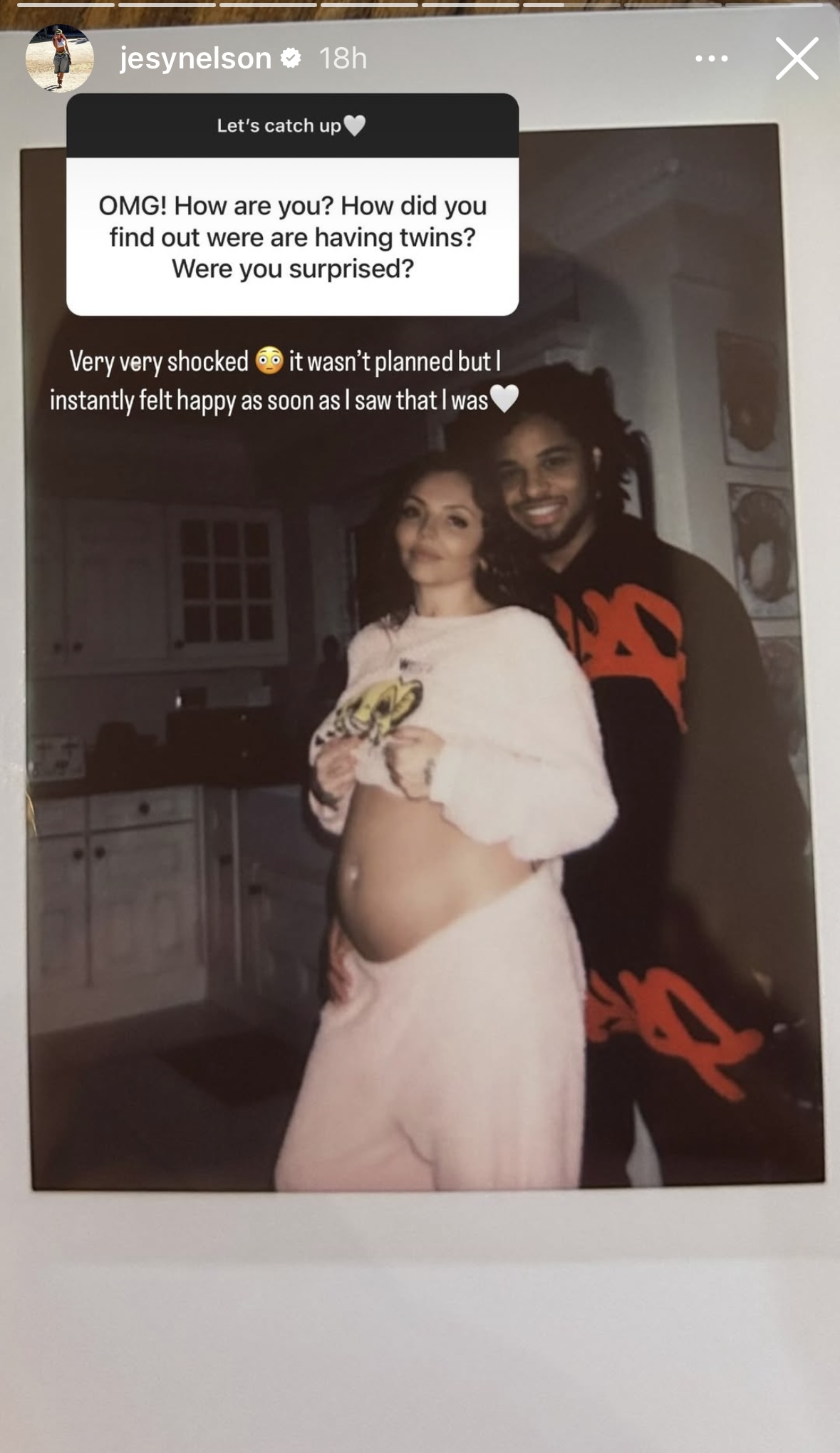 Jesy Nelson Instagram Story