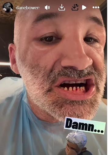 Dane Bowers shows off teeth on Instagram Story